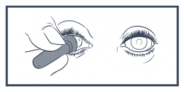 Cómo retirar y poner la prótesis ocular: Infografía Ocampo